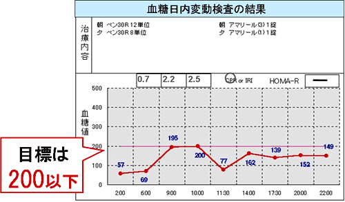 血糖日内変動